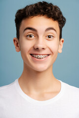 Closeup portrait of surprised boy with dental braces on teeth looking at camera