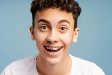 Amazed boy with dental braces on teeth looking at camera isolated