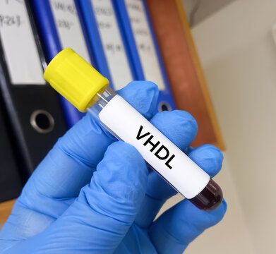 Blood sample for VHDL(very low density Lipoprotein) test, cardiovascular risk. Good cholesterol