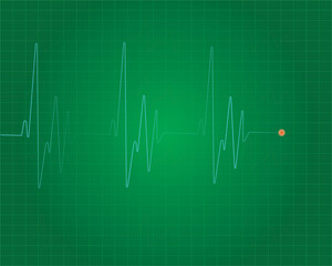 Heart beat line. Simple collection of cardiogram related line icons. Thin line vector set of signs for infographic, logo, app development and website design. Vector illustration.EKG - Heart Rate Monit