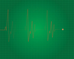 Heart beat line. Simple collection of cardiogram related line icons. Thin line vector set of signs for infographic, logo, app development and website design. Vector illustration.EKG - Heart Rate Monit