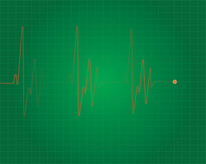 Heart beat line. Simple collection of cardiogram related line icons. Thin line vector set of signs for infographic, logo, app development and website design. Vector illustration.EKG - Heart Rate Monit