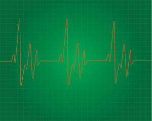 Heart beat line. Simple collection of cardiogram related line icons. Thin line vector set of signs for infographic, logo, app development and website design. Vector illustration.EKG - Heart Rate Monit