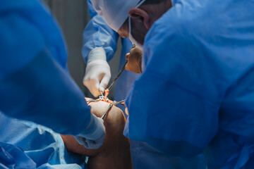 02.01.2024 Vinnytsia, Ukraine: two trauma surgeons work on a patient's knee joint reconstruction on...