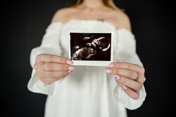 A pregnant woman holds a photo of her baby in her hands