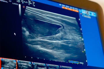 close-up in veterinary clinic screening on an abdominal ultrasound monitor - obrazy, fototapety, plakaty