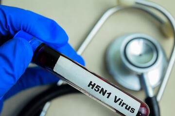 H5N1 Virus - Test with blood sample on wooden background. Healthcare or medical concept