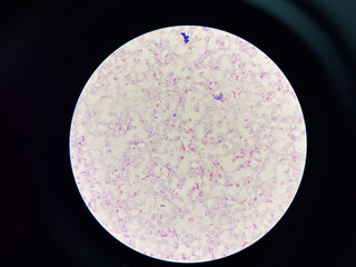 red cell Gram negative bacilli in hemoculture.