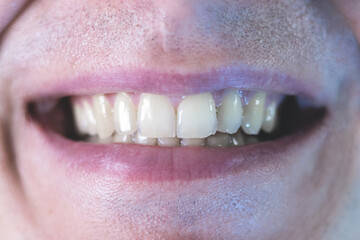 Man is smiling with teeth. Close up, man's mouth and lips.