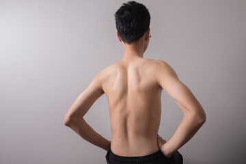Scoliosis treatment. young man with a severe curvature of the spine isolated on gray background.