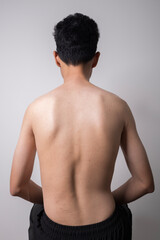 Fototapeta premium Scoliosis treatment. young man with a severe curvature of the spine isolated on gray background.