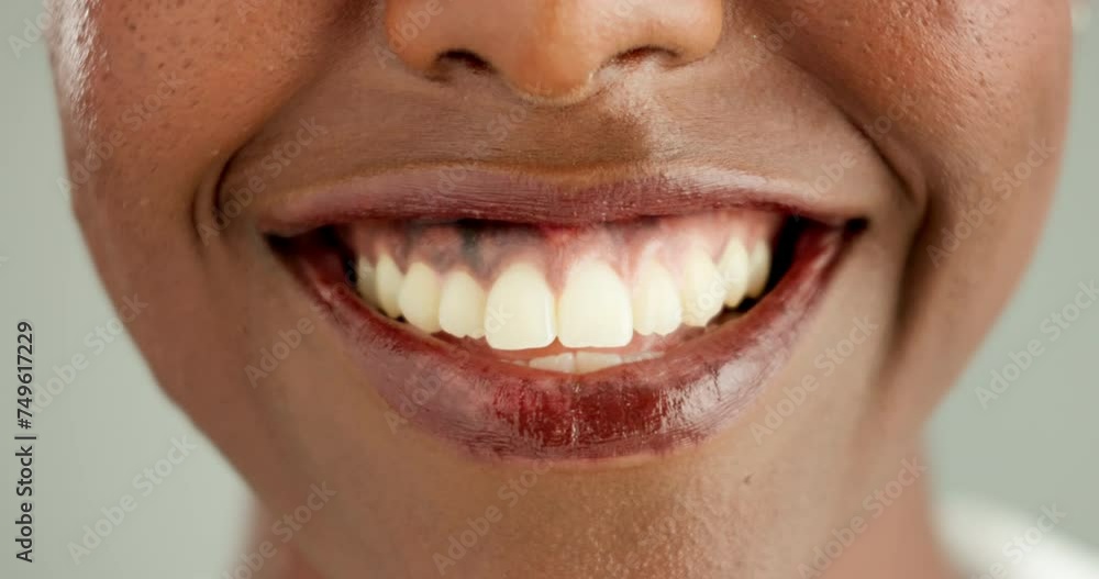 Poster Person, african and closeup with teeth, smile and dental care and oral hygiene or health. Mouth, zoom and lips with wellness, medical and happy woman with dentist results and whitening for beauty