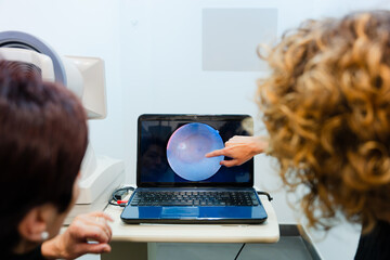Oculist explaining to patient the result of retinography on a laptop