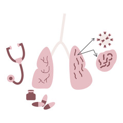 Lung cancer disease. Vector illustration in flat style with cancer disease theme. Editable vector illustration.