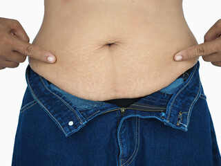 Naklejka premium Woman show off the belly after birth have stretch marks on white background. Closeup photo, blurred.