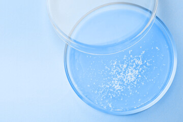 Petri dish with different sample on light blue background, top view. Space for text. Laboratory glassware