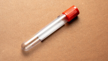 Doping Test, One tubes with athlete's blood taken for doping.