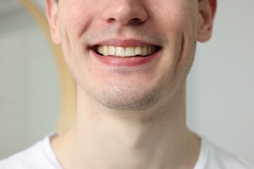 Young man using whitening strip on blurred background, closeup