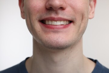 Fototapeta premium Young man using whitening strip on light background, closeup