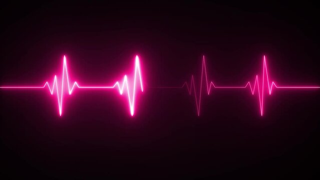 This is an electrical activity of heart. This can present various types of diseases of heart. This is used as initial investigation of heart.