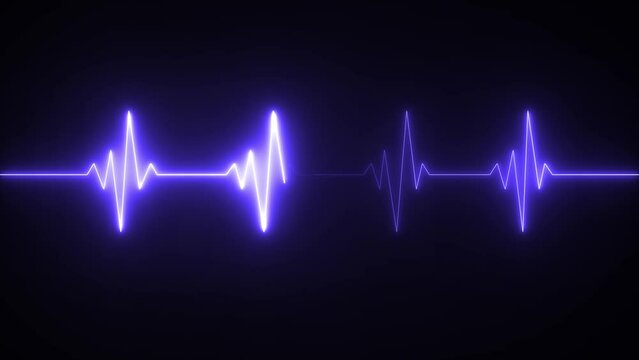 This is an electrical activity of heart. This can present various types of diseases of heart. This is used as initial investigation of heart.