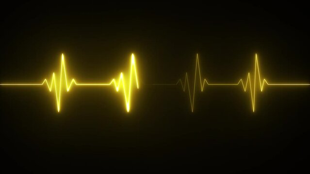 This is an electrical activity of heart. This can present various types of diseases of heart. This is used as initial investigation of heart.