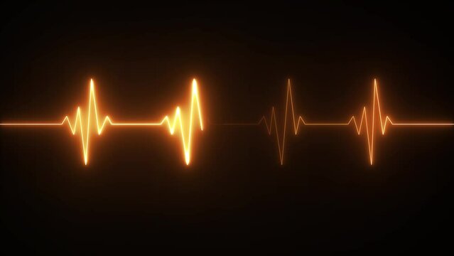 This is an electrical activity of heart. This can present various types of diseases of heart. This is used as initial investigation of heart.