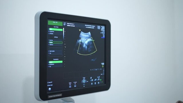 Doctor operating Ultrasonography (USG) tools for pregnant woman