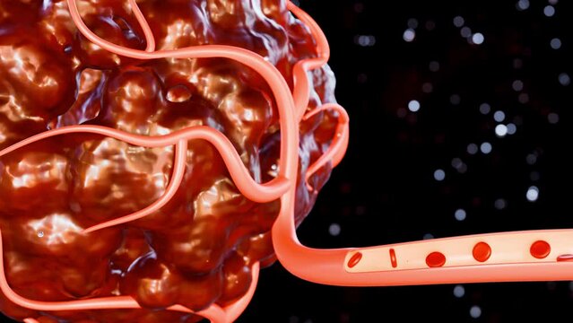 3d animation of cancer requires a blood supply to deliver the nutrients and oxygen it needs to grow and survive
