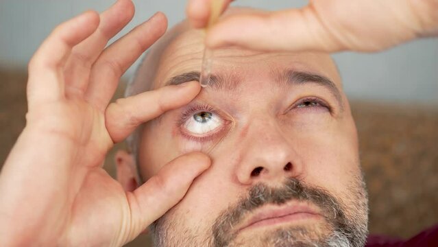 Man applying eye drops in dry irritated eyes sitting on sofa at home. Person using eyedrops antihistamine ophthalmic antibiotic medication for allergy. Male with vision problems, nearsightedness