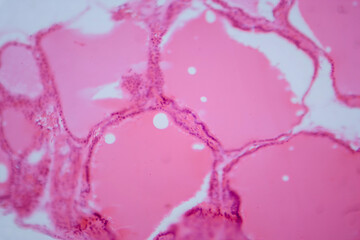 Thyroid gland under a microscope, light micrograph exhibiting typical follicular structure and...