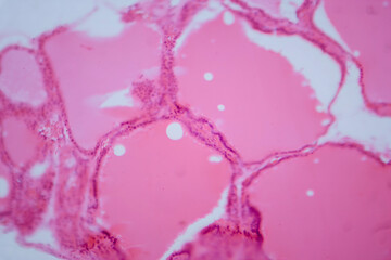 Thyroid gland under a microscope, light micrograph exhibiting typical follicular structure and colloid-filled follicles