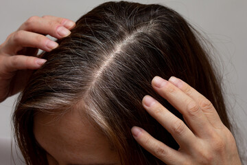 Top view of regrowth root with grey hair