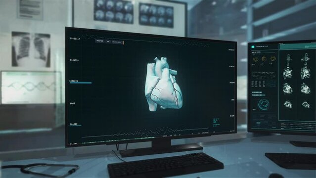 Heart organ analysis at the modern healthcare center. Medical program deals with the heart organ analysis. Heart organ analysis displaying the dangerous Cardiac Ischemia illness. Treatment.