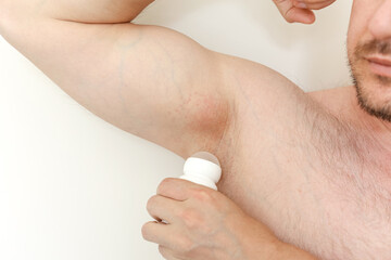 Cropped photo of irritation, inflammation on sensitive underarm skin after using toxic deodorant or antiperspirant. Armpit rash. Allergy, atopic dermatitis. Acne or red spots. Shaving effect