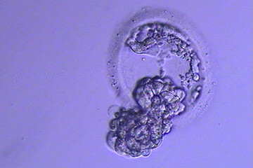 Day 5 Blastocyst, #1 of 2 before implantation IVF FET