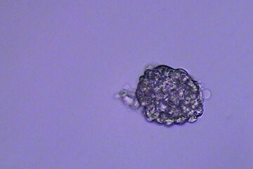 Day 6 Blastocyst, #2 of 2 before implantation IVF FET