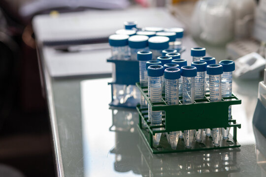scientific research, tubes on a glass table in scientific laboratory