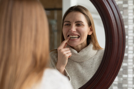 White girl puts on a clear braces while looking in the mirror