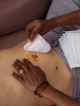 Woman removing patch from surgery stitch on husband