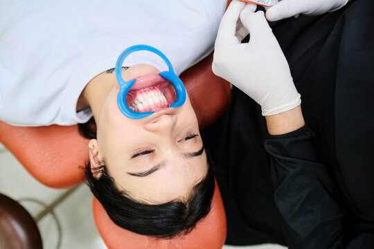 Patient lying down with a mouth opener in her mouth