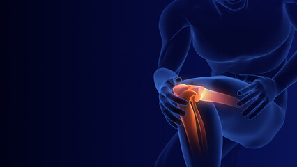 Pain in the leg medical animation
