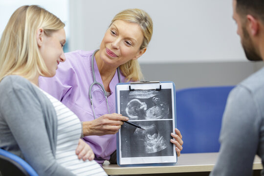 female doctor shows ultrasound picture to the young pregnant couple