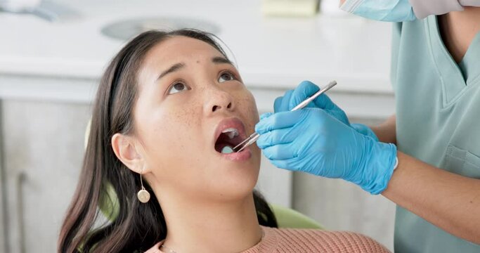 Asian woman, dentist and patient with cleaning tools for mouth, oral or gum in dental care at clinic. Face of female person in relax with orthodontist for tooth whitening, hygiene or removing cavity
