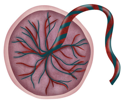 Placenta anatomy  is a temporary organ that forms in your uterus during pregnancy.  and umbilical cord.