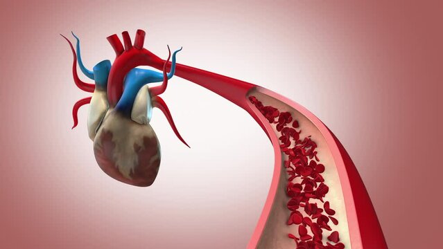Artery and blood in the human heart