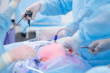 Minimally invasive surgery, team doctors use medical equipment, operating room hospital. Doctor...