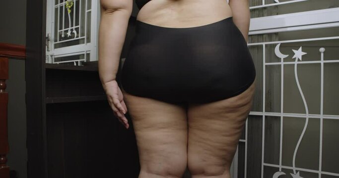 Asian oversize woman care about cellulite on her legs. Excess fat, Unhealthy lifestyle, Diet concept.