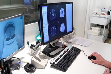 MRI scan of brain on Monitor in control room and and monitoring patient