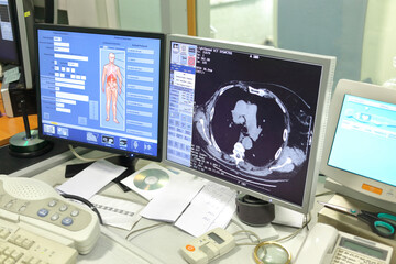  Monitor screen in radiology X-ray examination in multidisciplinary clinic CELT